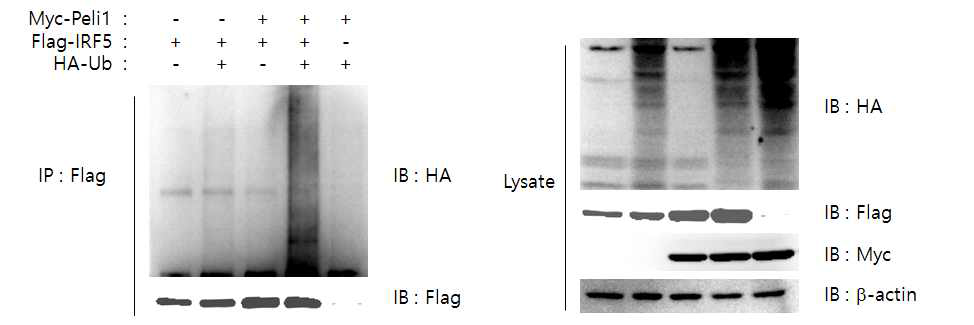 Pellino1에 의한 IRF5의 Ubiquitination을 세포주에서 확인