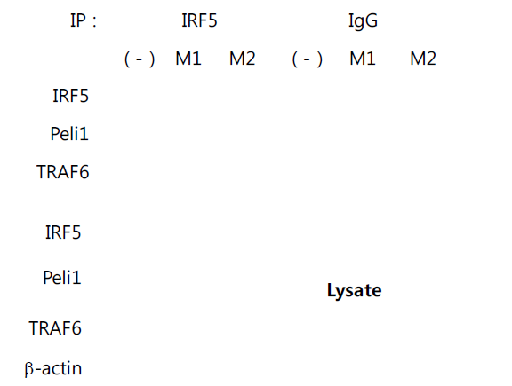 Pellino1과 IRF5의 결합을 생체 유래 세포에서 확인