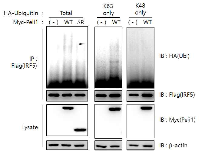 Pellino1에 의한 K63-linked IRF5 Poly-Ubiquitination