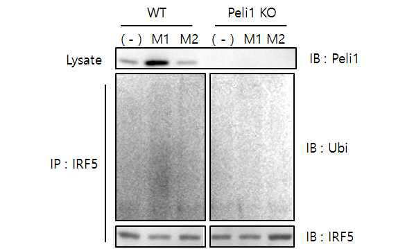 Pellino1에 의한 M1 조건에서의 IRF5의 Ubiquitination을 마우스 대식 세포에서 확인