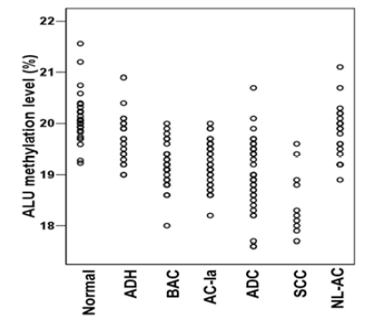 Comparison of ALU methylation levels in multistep lesions of lung carcinogenesis. ALU methylation level was significantly decreased from normal lung to ADH and from ADH to BAC. However, no significant difference was noted in the transition from BAC to ADC. There was a marked difference in the ALU methylation level between adenocarcinoma and squamous cell carcinoma samples.