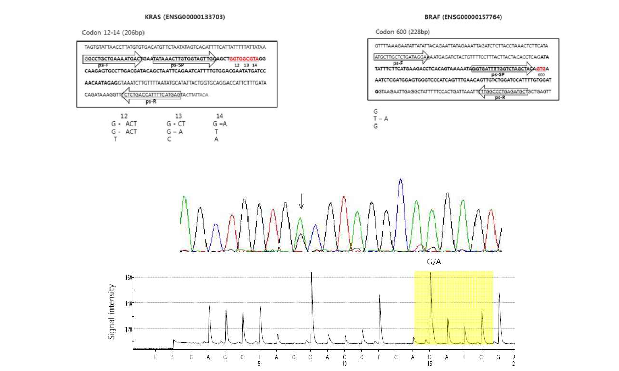 직접염기서열분석법(위)과 Pyrosquencing법(아래)에 의한 KRAS codon12의 돌연변이 GGT>GAT