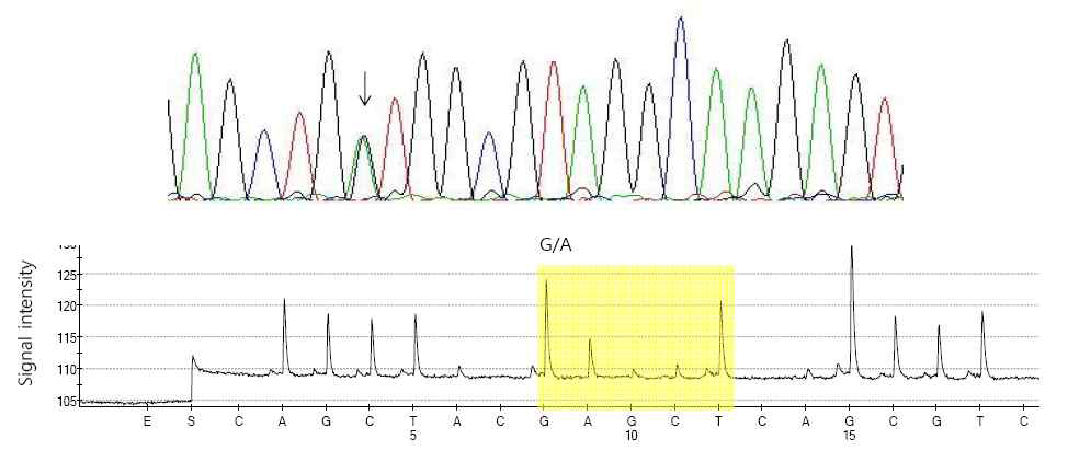 직접염기서열분석법(위)과 Pyrosquencing법(아래)에 의한 KRAS codon13의 돌연변이 GGC>GAC