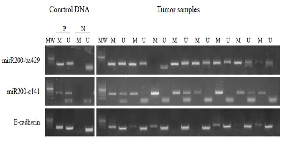 Representative MSP assay for miR200-429, miR200-141, and E-cadherin gene methylation in gastric cancer