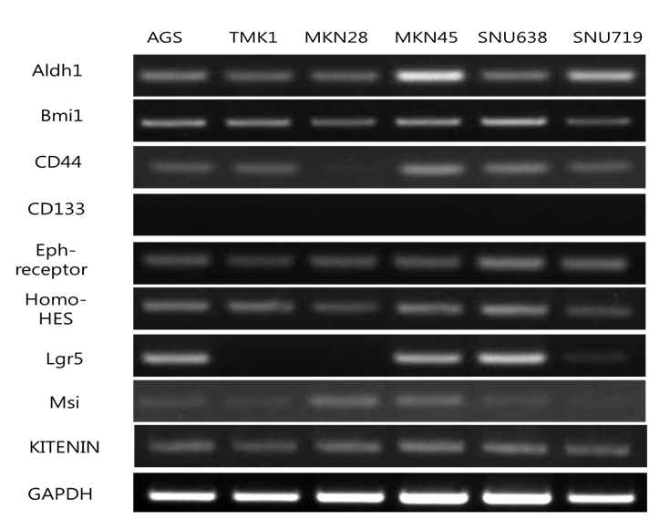 Expression of EMT marker genes by RT-PCR 35 cycles