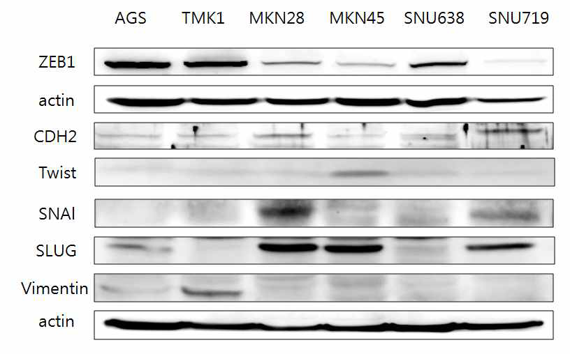 Expression of EMT proteins by wester blot analysis