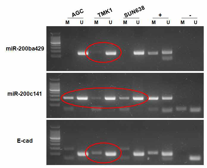 Investigation of promoter methylation of mir200 family and CDH1 genes in TMK1 cell line