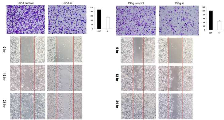 Invasion and migration assay after performing ZEB1 knock-down in U251 and T98G cell-lines