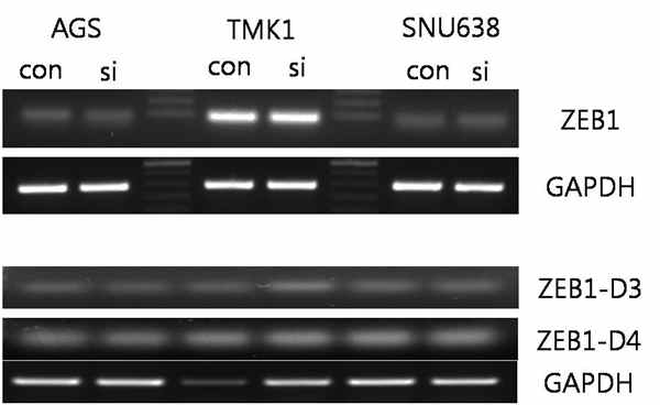 In comparison, ZEB1 knockdown using siRNAs in gastric cancer cell lines, AGS, TMK1 and SNU638, has not been established yet. Trials on ZEB1 knockdown is being performed using various siRNAs