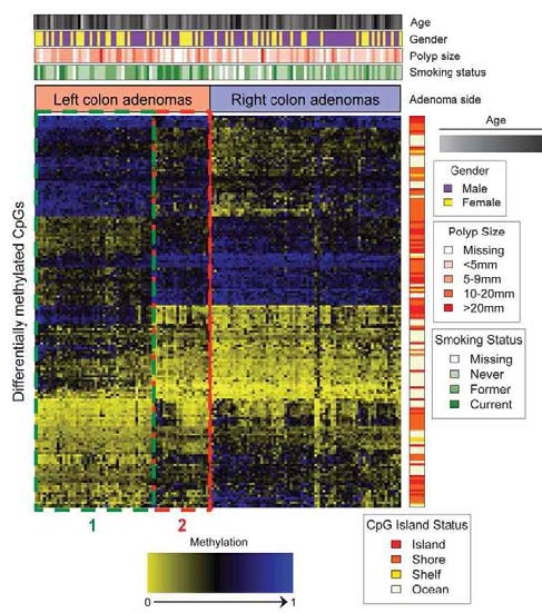 Heat map of the 168 significantly differentially methylated CpG loci between rightand left-colon adenomas. Methylation values are presented as unmethylated (yellow) to methylated (blue). Rows are represented by the 168 differentially methylated loci and columns represent subjects who are grouped based on adenoma side. On the right-hand side of the heat map is a color side bar, which indicates the island status for the 168 CpG loci. Above the heat map are color side bars that indicate smoking status, polyp size, gender, and age for the study subjects. Red and green dotted boxes indicate two subgroups of left-colon adenoma subjects, referred to as subgroups 1 and