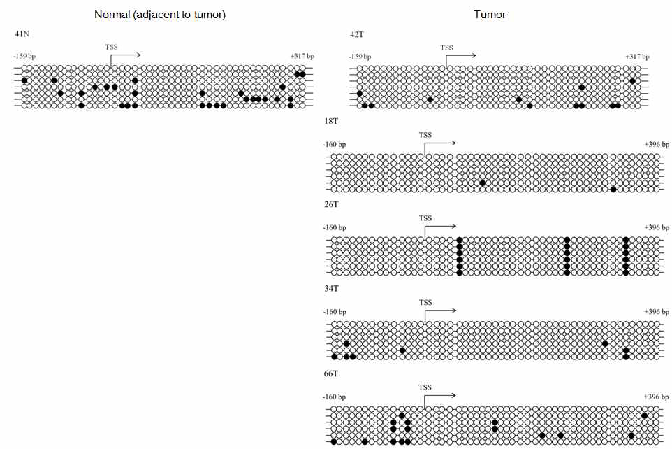 Methylation analysis of CDH1 gene of normal and tumor tissue in early onset gastric cancer