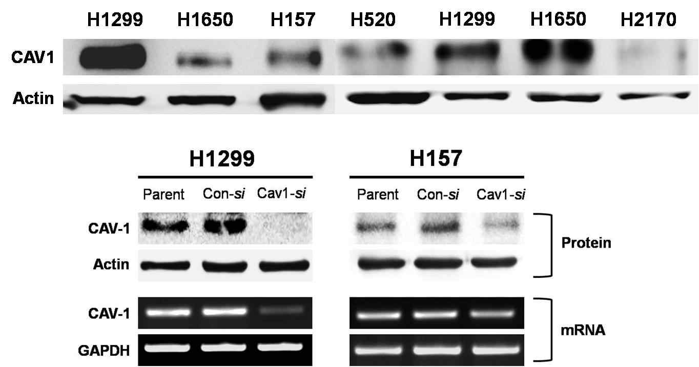 암종세포주에서 CAV1 기저발현을 조사한 Western blot 밴드와 H1299와 H157에서 CAV1 siRNA를 처리하여 CAV1 발현 억제를 확인한 RT-PCR과 WB 결과