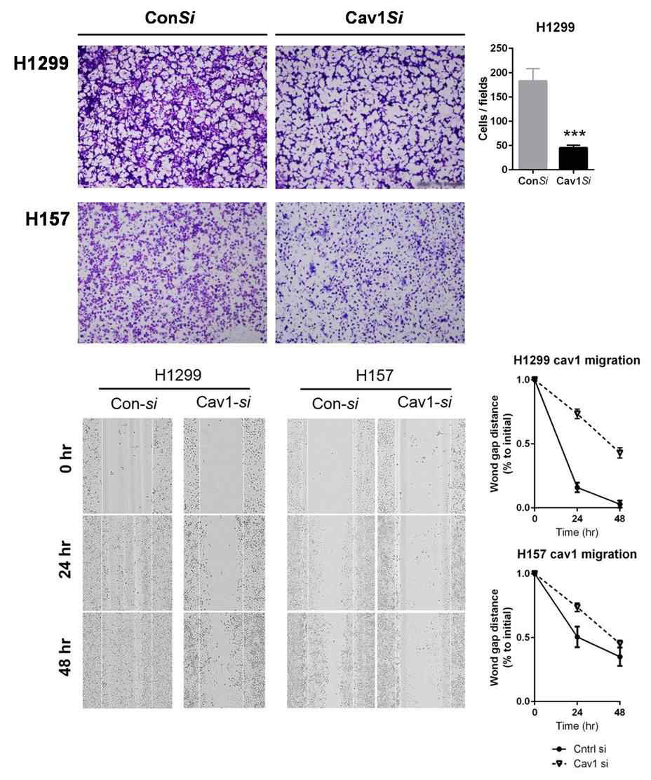 H1299와 H157에서 CAV1 siRNA를 처리하여 CAV1 발현을 억제 시켰을 때 invasion assay 결과와 wound healing migration assay 결과