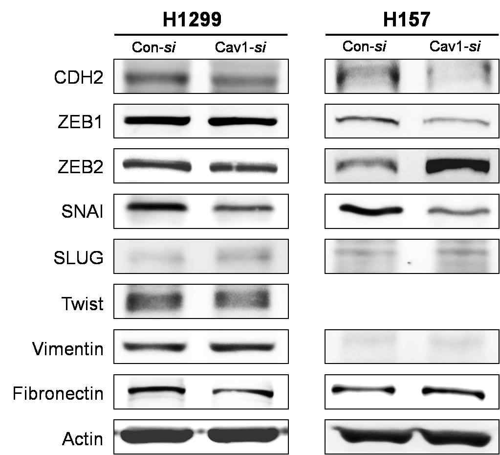 암종세포주 H1299와 H157에서 CAV1 siRNA를 처리하여 CAV1 발현을 억제 시켰을 때 EMT인자의 발현변화를 western blot 방법으로 조사함