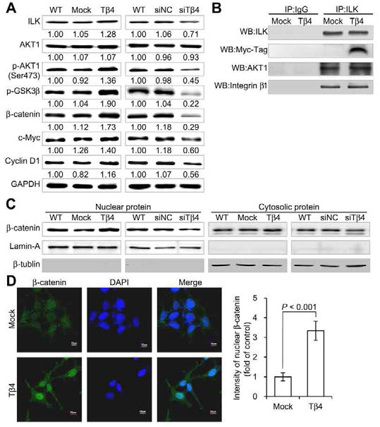 signaling casca det.h e( A)I LLKe/vAeKlsT /oβf spirgontaeliinnsg rcealsacteadd e tow erIeL Km/AeKaTsu/rβe-dc autesninign iWnteesrtaecrtn wbiltoht tinTgβ. 4 (Bw)e reM odleectuelcetse d thbayt iamntmibuondoyp.r eIcmipmituantoiopnr ecuipsiitnagti ona nb y aIngtGi- wILaKs ulosceadli zaatsio nt hoef βc-onctartoeln. in( Cw)a s Indteetrecremlliunleadr ucysitnogp lasWmeics tefrrna ctiobnlost tiwnge.r e Nisuocllaetaerd aanndd eimqumaul nobloatmteodu ntuss ing oafn anetai-chβ -cawteenrien aunsteidb oadsy . nuLcalemairn -anAd acnydto pβla-stmuibcu lcino ntwroelrse. T(Dβ)4 -Nuupcrleegaur laltoecda lizaCtiaocno -o2f β-ceclalste ninw ains dimetmeucnteodfl uorescaenndc e qsutaanintiifnige.d Tbhye choismtopgarraemd tsoh owesm ptyr elavtievcet or incteonnstritoiless. SVDal.u eBsa r r=ep r1e0s eμnmt