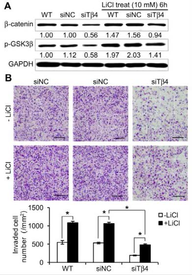 Invasion ability of Tβ4-downregulated Caco-2 cells is restored by a GSK3β inhibitor