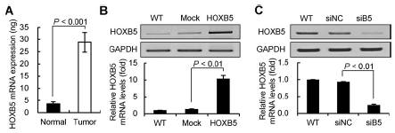 HOXB5 is frequently overexpressed in gastric cancer cells