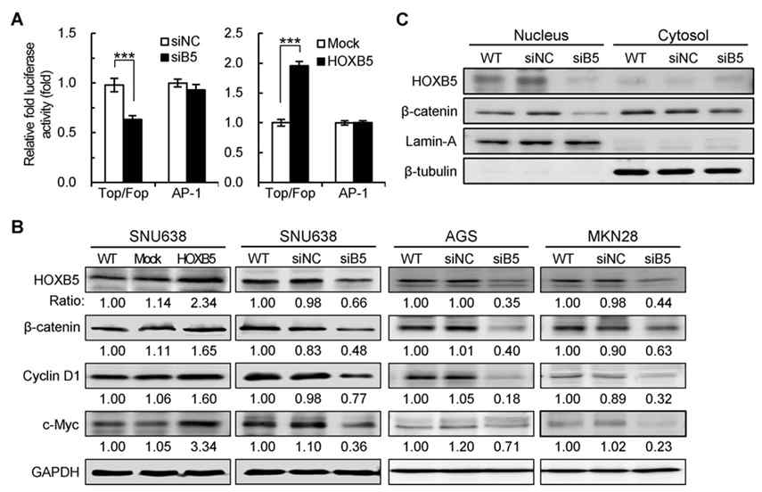 HOXB5 is associated with the transcriptional activity of the β-catenin/TCF/LEF complex