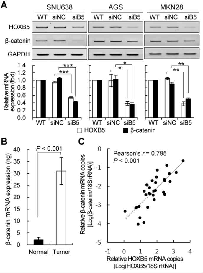 β-catenin expression in gastric cancer cells was positively correlated with HOXB5 expression