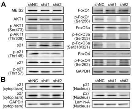 MEIS2 regulates AKT1 expression and its signaling pathway