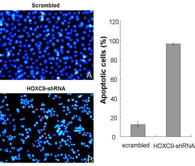 Effects ov HOXC9 specific shRNAs on apoptosis