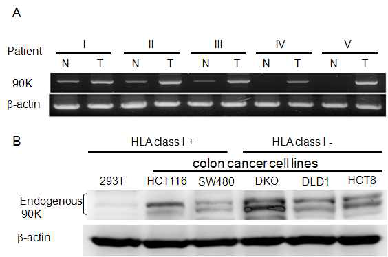 Expression of 90K gene and protein in colon cancer tissues and cells. (A) The expression of 90K was performed from extraneoplatic (Normal, N) and neoplastic lesion (Tumor, T) in 5 human colon patients by RT-PCR. (B) The expression of 90K protein in colon cancer cell lines was estimated by western blot. 293T cells were used negative control of 90K expression. 293T, HCT116, and SW480 cells were HLA class I positive but DKO, DLD1, HCT8 cells were HLA class I negative and cells