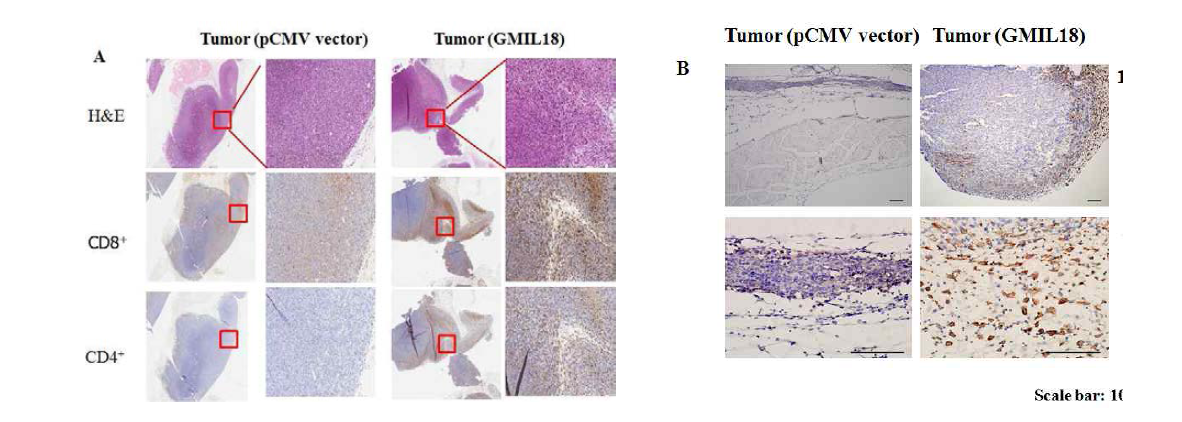 H&E and IHC staining with anti-CD4 and anti-CD8 T cells in irradiated GMIL18 secreting vaccine treated mice tumors. Mouse colon cancer CT26 cells (1 x 106) were inoculated on the right flank region of BALB/c mice. The tumor size reached to about 0.5 ㎠ and then irradiated CT26GMIL18 (tumor vaccine) injected to tumor surrounded. The mice were sacrified at 5 days later, (A) Paraffin-embedded tumor sections were stained with H&E and IHC stained with anti-CD4+ and anti-CD8+ T-cells antibody. Immunohistochemical analysis of these tumor sections demonstrated that GMIL18 fusion protein significantly enhanced infiltration of CD4+ and CD8+ T in tumors compared with the vector only tumor vaccine-treated group. (B) GMIL18 group is NK cell heavy infiltration in the tumor site. Brown spots determined the infiltration of T cells