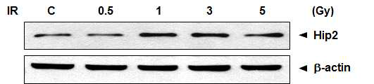 IR 조사 양에 따른 Hip2 단백질의 변화