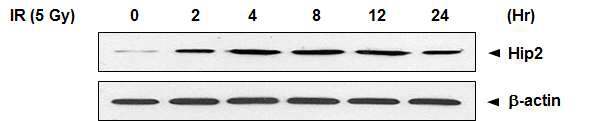 IR 조사 후 시간에 따른 Hip2 단백질의 변화