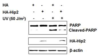 UV 조사 시 Hip2에 의한 PARP cleavage의 감소