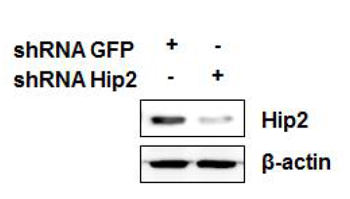shRNA-Hip2에 의한 Hip2의 발현 억제