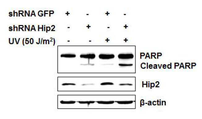 Hip2의 Knock-down 후 UV 조사 시 PARP cleavage의 증가