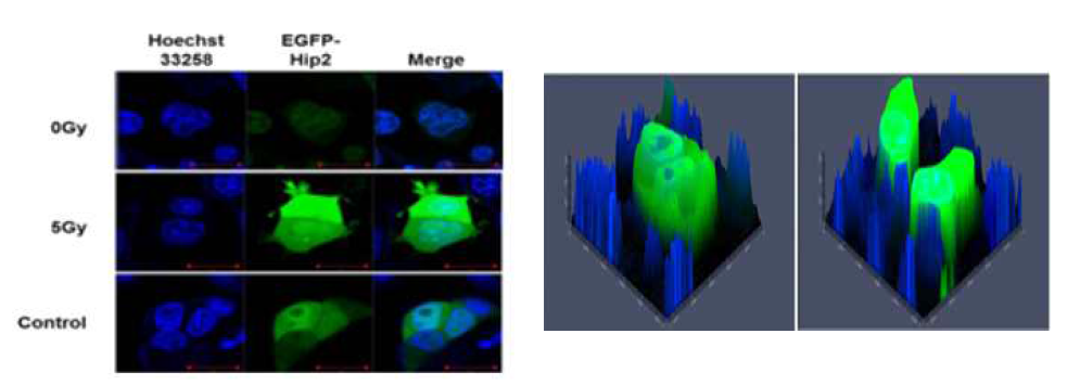 방사선 조사 시 핵과 세포질에서의 Hip2 단백질 안정성의 차이