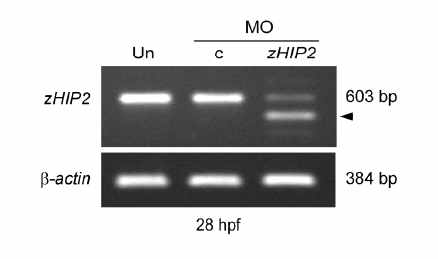 RT-PCR을 통한 zHip2의 transcription 감소 확인