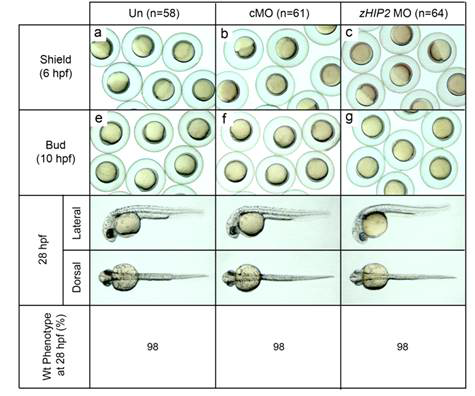 zHip2의 발현 억제 후 발생단계의 zebra fish 표현형 관찰