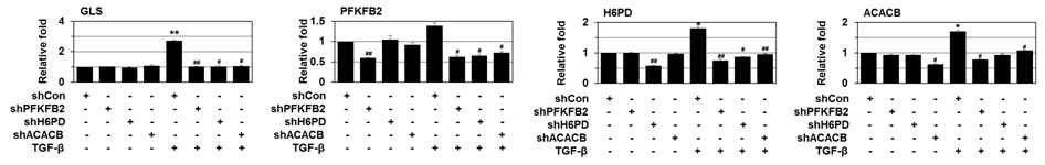 PFKFB2/H6PD/ACACB 불활성화에 의한 TGF-β -induced GLS/PFKFB2/H6PD/ACACB 발현 억제