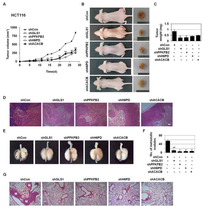 GLS1/PFKFB2/H6PD/ACACB 불활성화에 따른 tumorigenicity 및 metastasis 억제