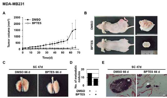 GLS1 억제에 따른 breast cancer growth 및 metastasis 억제
