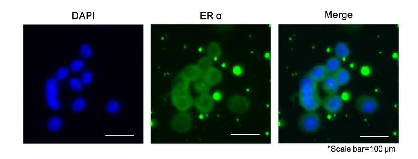 Immunofluorescence를 이용한 tumorsphere 세포에서 non-genomic ERα 단백질의 발현확인