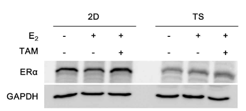 Monolayer(2D)와 tumorsphere(TS) 세포의 E2와 tamoxifen에 대한 ER의 발현 변화