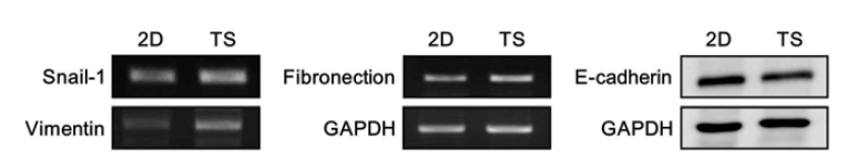 Monolayer (2D)와 tumorsphere (TS) 세포의 EMT 발현 변화