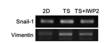 Tumorsphere (TS)세포에 대한 Wnt signaling과 EMT와의 연관성 확인