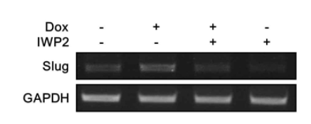 IWP2에 의한 Doxorubicin에 의해 유도된 Slug 발현 저해효과