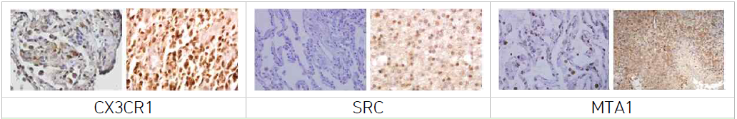 확보한 검체에서의 전이성 뇌종양 전이표적인자 후보군의 검증(IHC)
