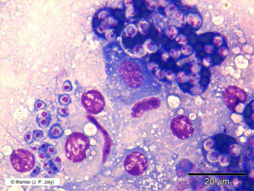 Mytilus galloprovincialis digestive gland imprint with numerous young stages (arrow) and sporangia (double arrow). Hemacolor® staining (X100 objective).