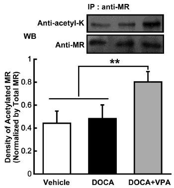 MR acetylation