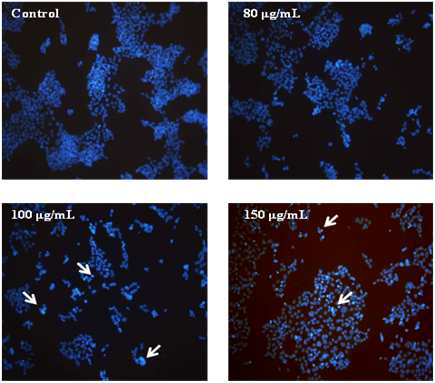 Apoptotic morphological changes on HCT116 cells for 72 h.
