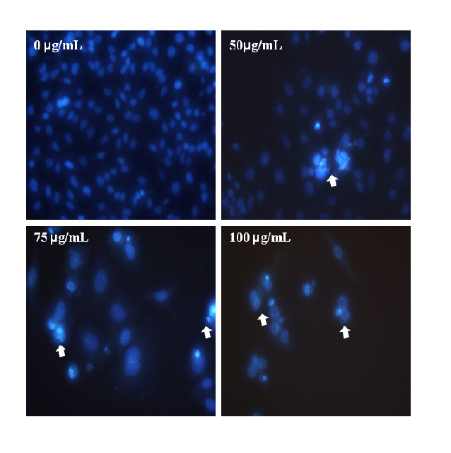 Effect of Moringa oleifera fruit-treated on level of apoptosis through Hoechst 33258 staining 0n A2058human melanoma cells.