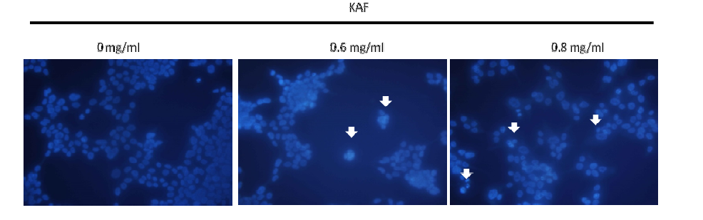 Effect of Kigelia africana treated on level of apoptosis through Hoechst 33258 staining in HCT116 cells.