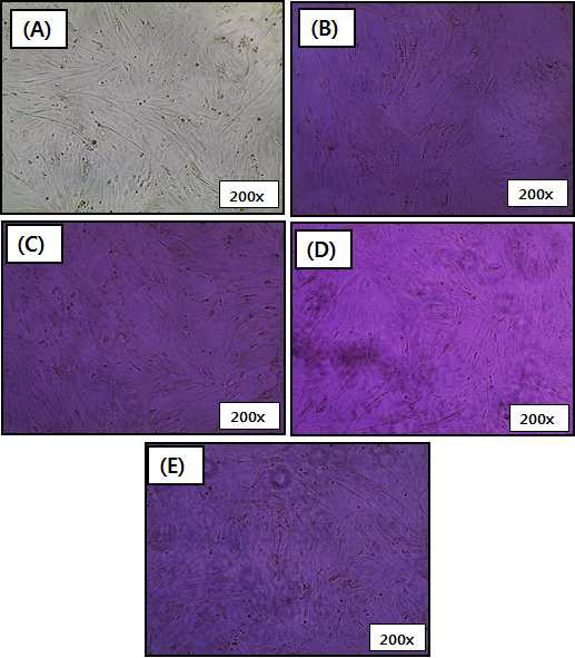 (A) H9C2 Pre-Treatment, (B) DMEM control treatment, (C) Incubator Control treatment, (D) Air treatment, and (E) NP treatment; imaged at 200x magnification